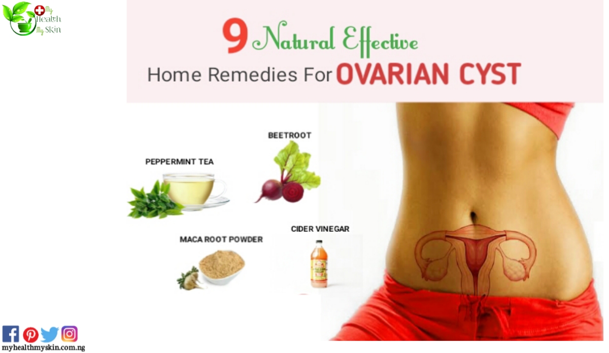 Ovarian cysts home remedies