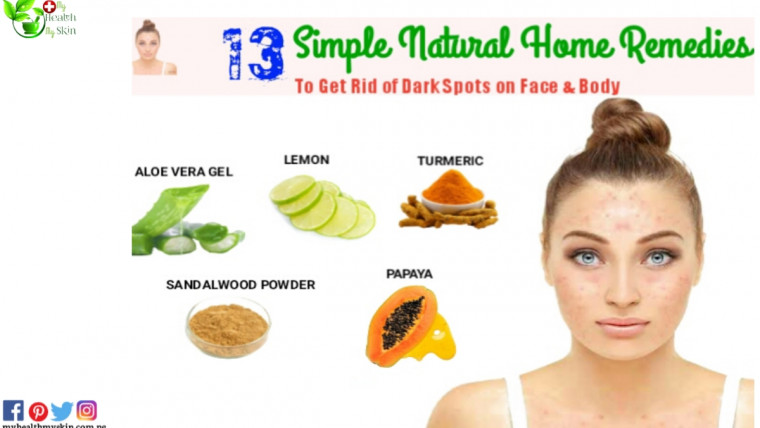 home remedies for dark spots