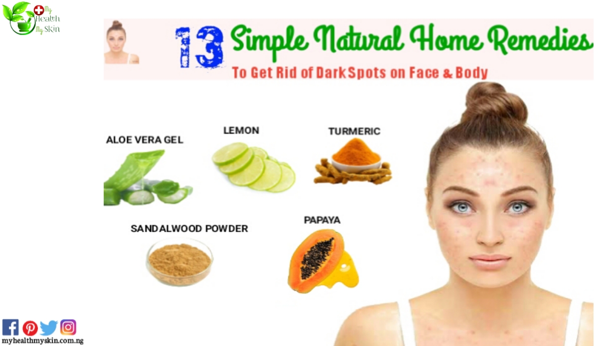 home remedies for dark spots