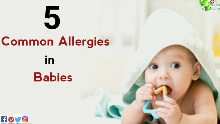 Common Allergies in Babies