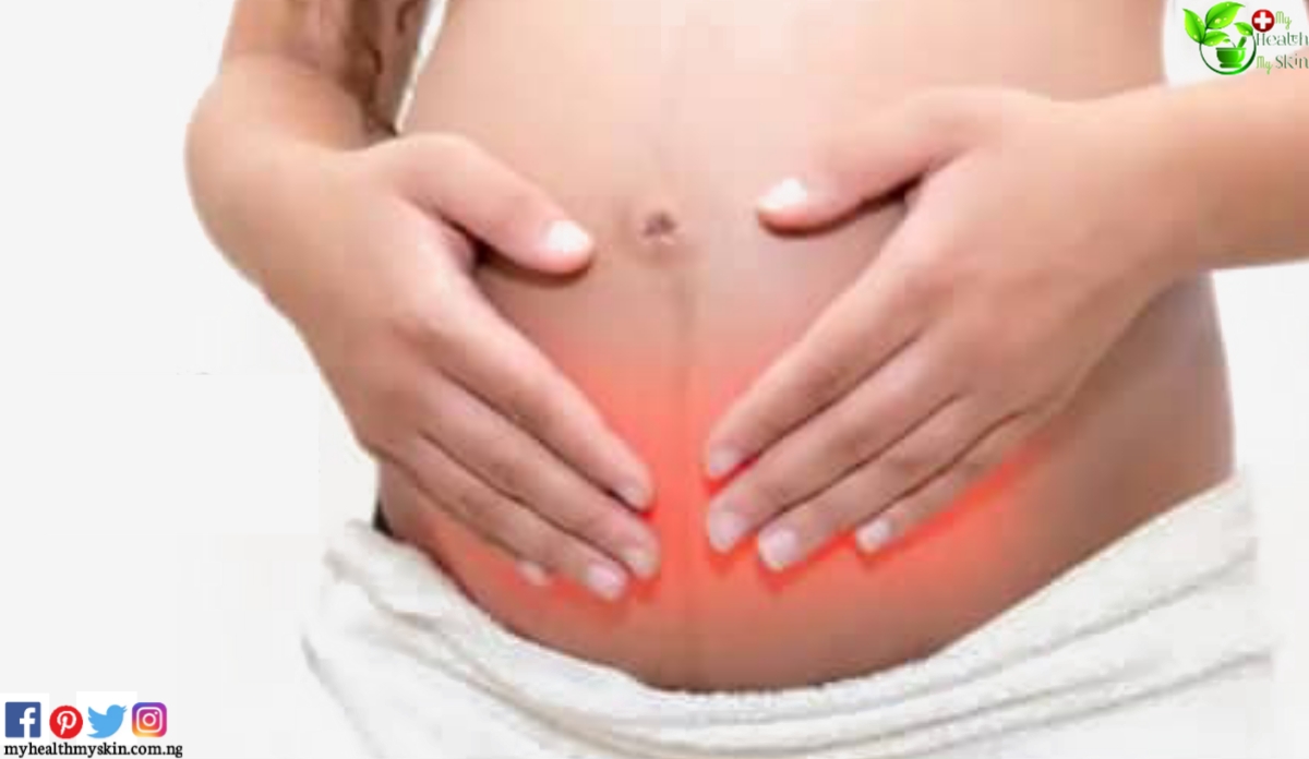 Itching during pregnancy