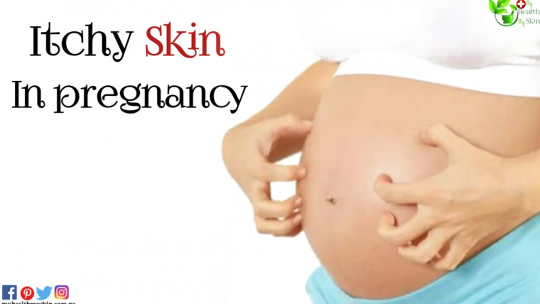 itchy skin pregnancy