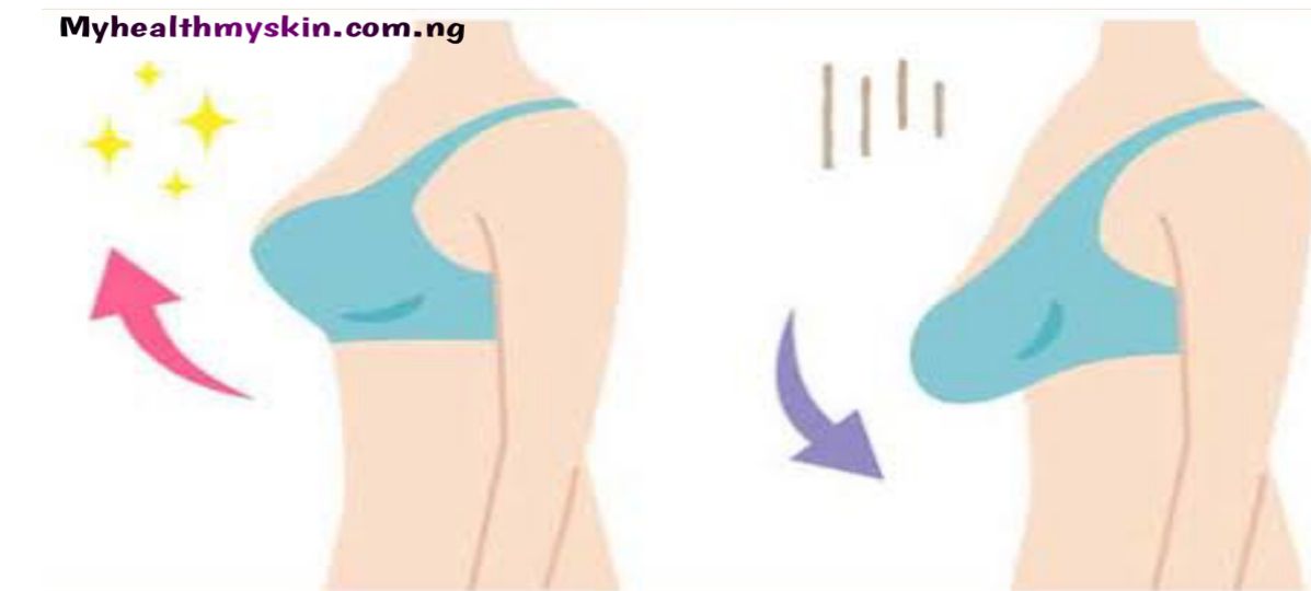 Does pressing breast cause sagging?