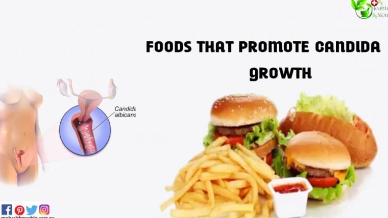 Foods That Promote Candida Growth