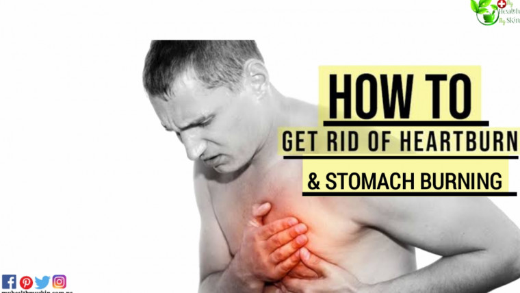 Home Remedy for Heartburn and Stomach Burning0A