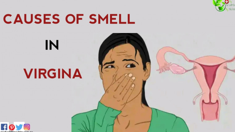 causes of smell in virgina
