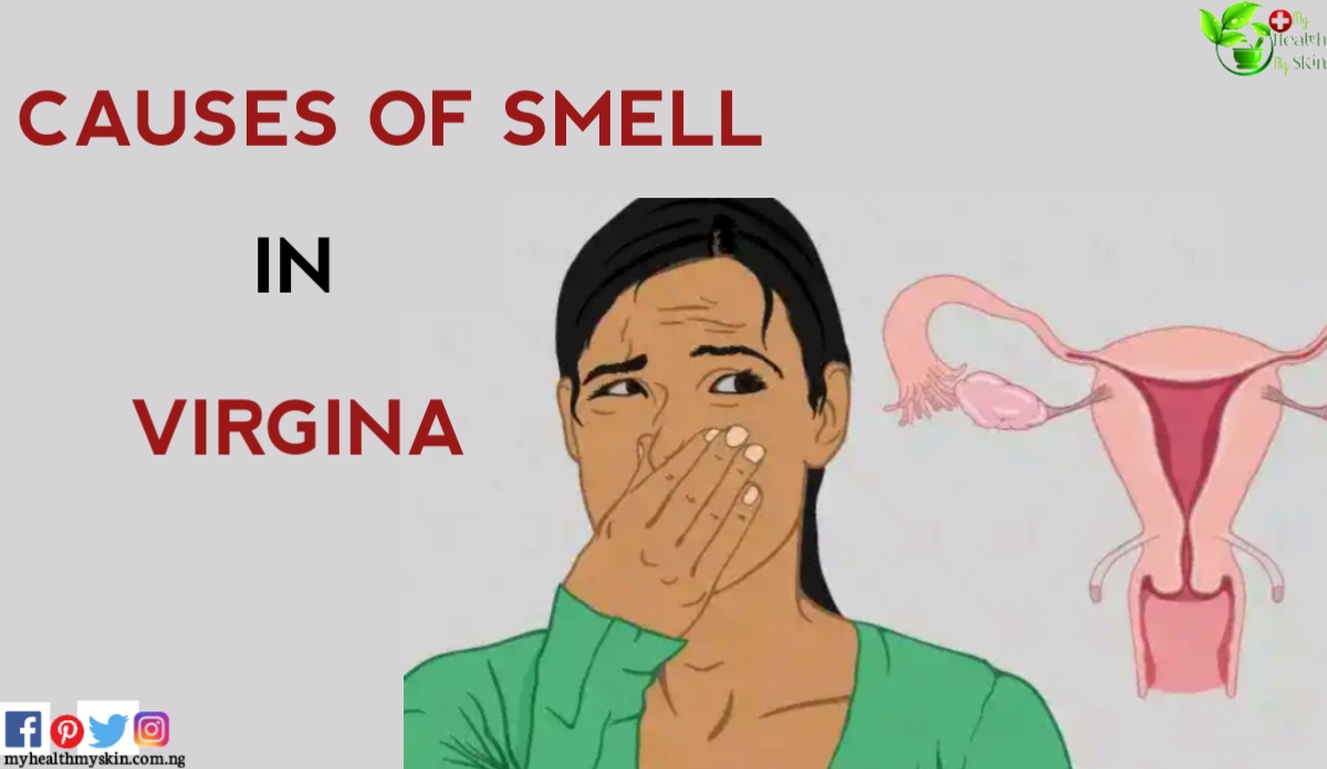 causes of smell in virgina