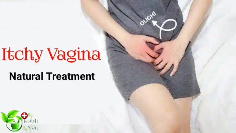 itchy vagina natural treatment