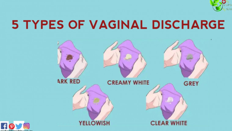 types of virgina discharge
