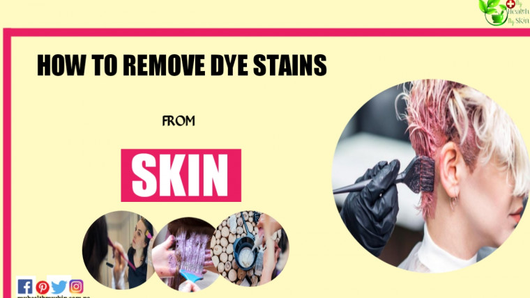 how to remove dye stains from skin