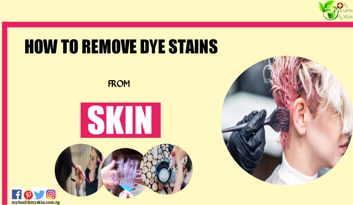 how to remove dye stains from skin