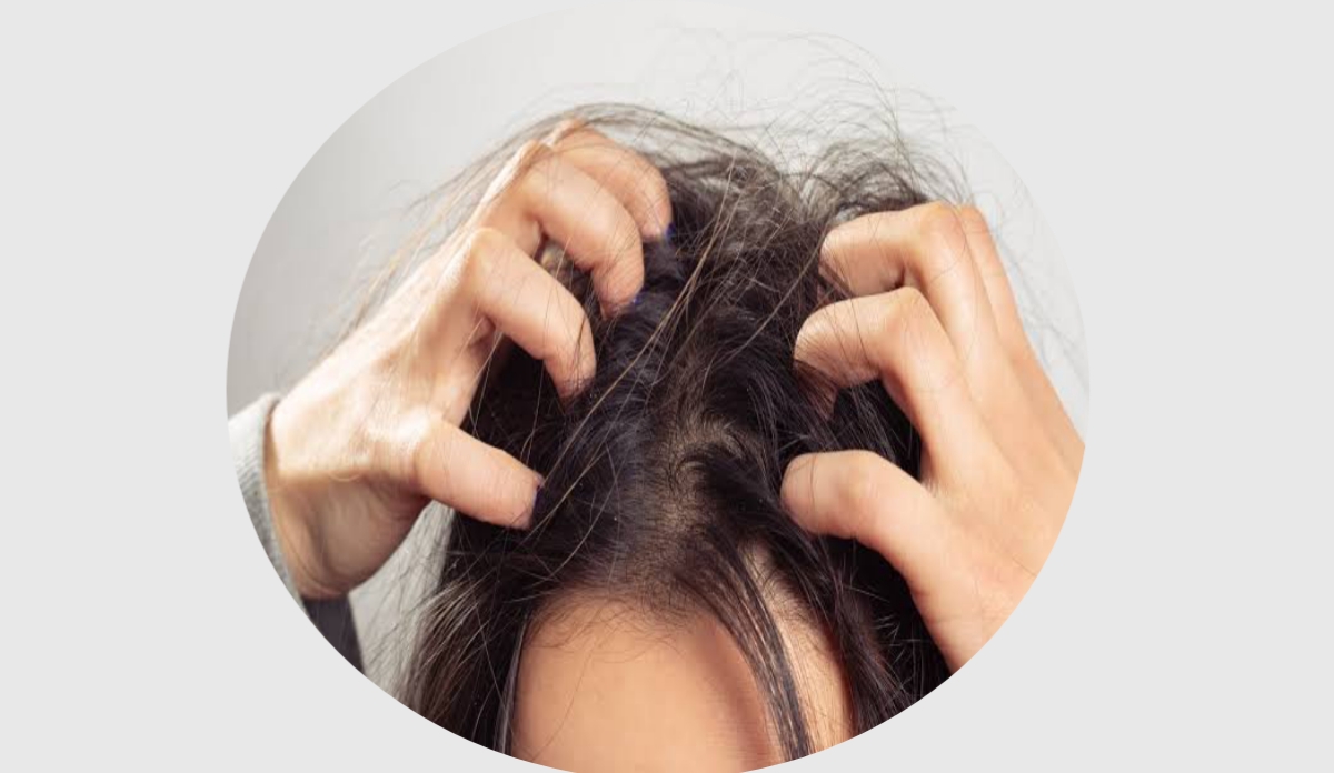 Itchy Scalp: What It Is And How To Stop Having An Itchy Scalp 