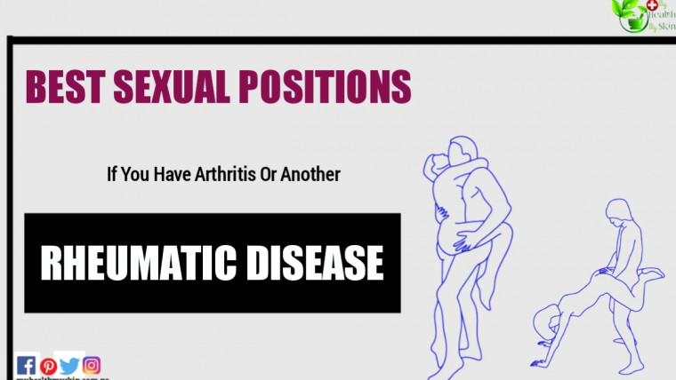 These are the Best Sexual Positions If You Have Arthritis Or Another Rheumatic Disease