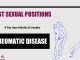 Best Sexual Positions If You Have Arthritis Or Another Rheumatic Disease