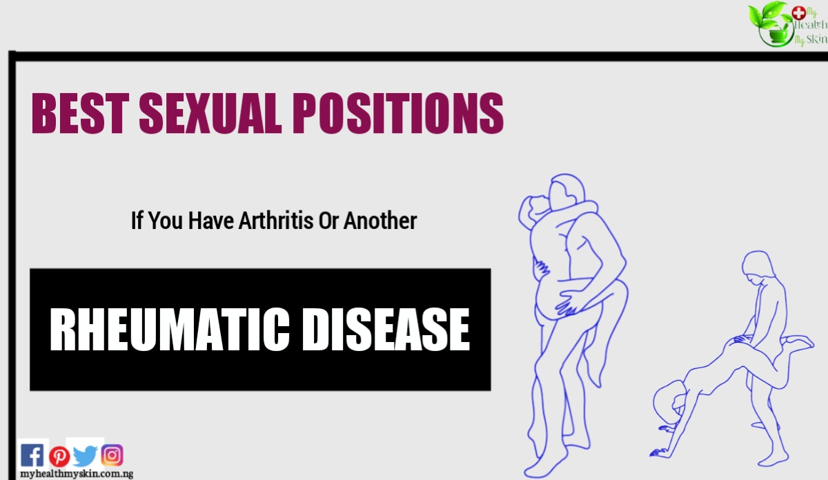 These are the Best Sexual Positions If You Have Arthritis Or Another Rheumatic Disease