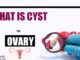 What Is Cyst On Ovary, Different Types of Cysts