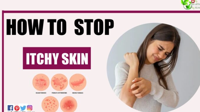 How to Stop Itchy Skin