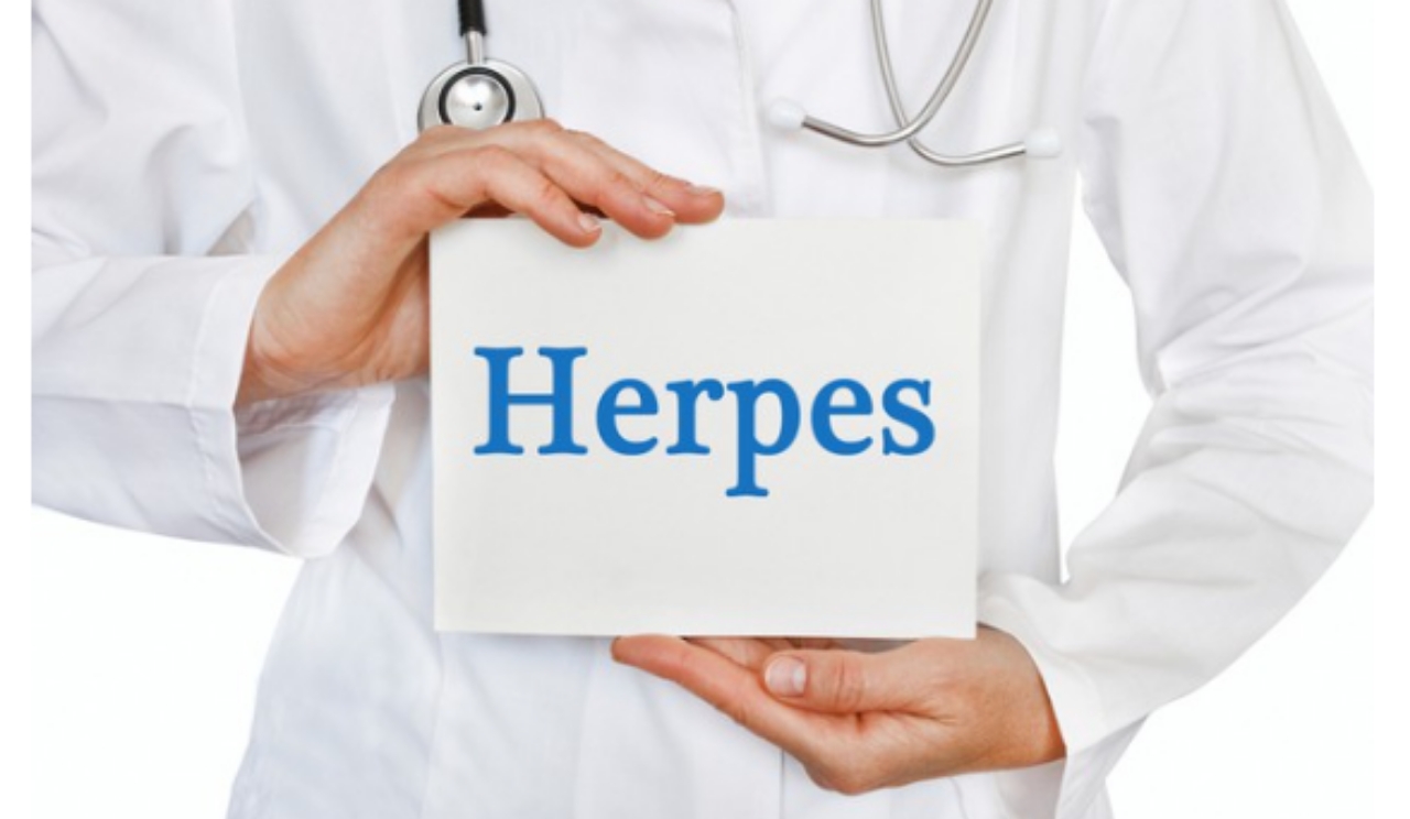 Genital Herpes: Common Symptoms, Treatment And Prevention