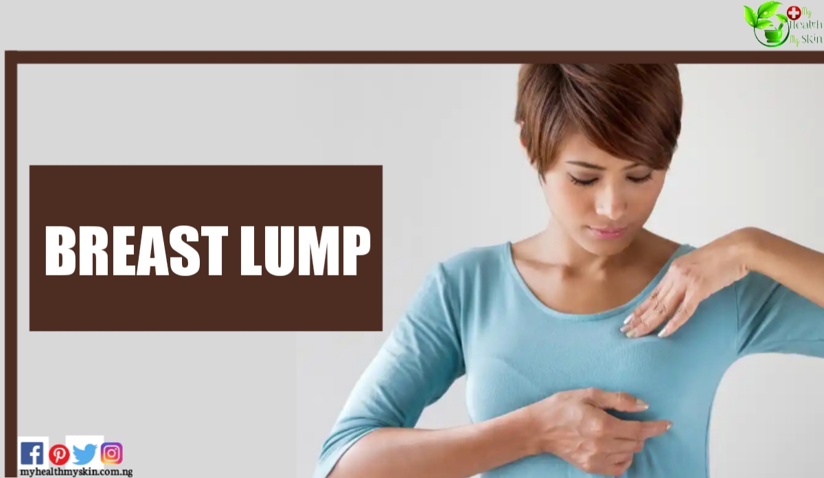 Breast Lump: What Can It Be And What To Do
