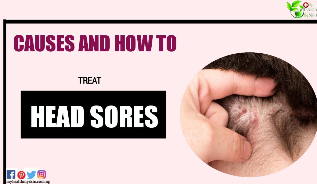 Head Sores Causes And How To Treat