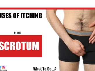 Itching in the Scrotum: Causes and What to Do