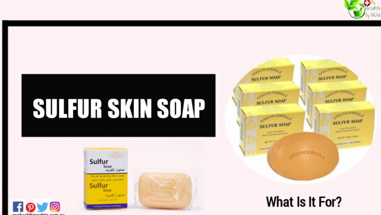 Sulfur Skin Soap – What is it for?