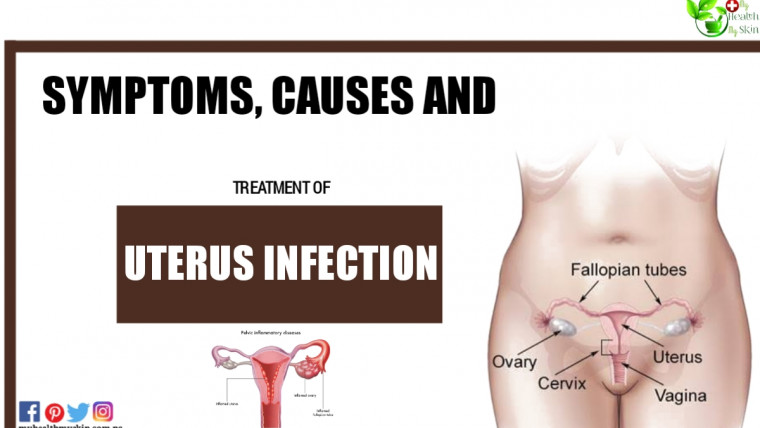 Uterus Infection Symptoms Causes and Treatment