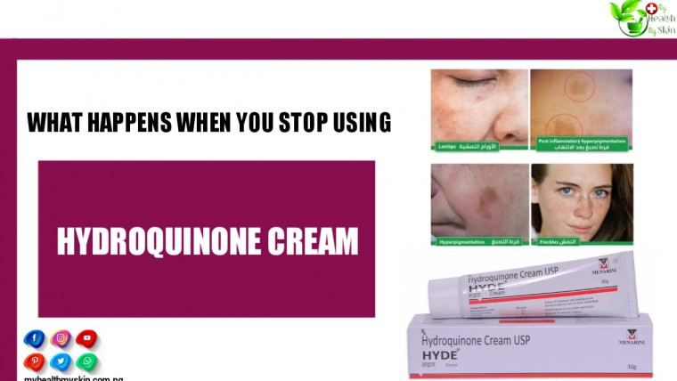 What Happens When You Stop Using Hydroquinone Cream
