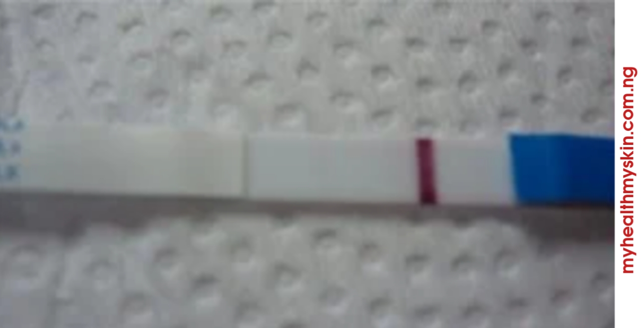 Positive Pregnancy Test – Photo Gallery