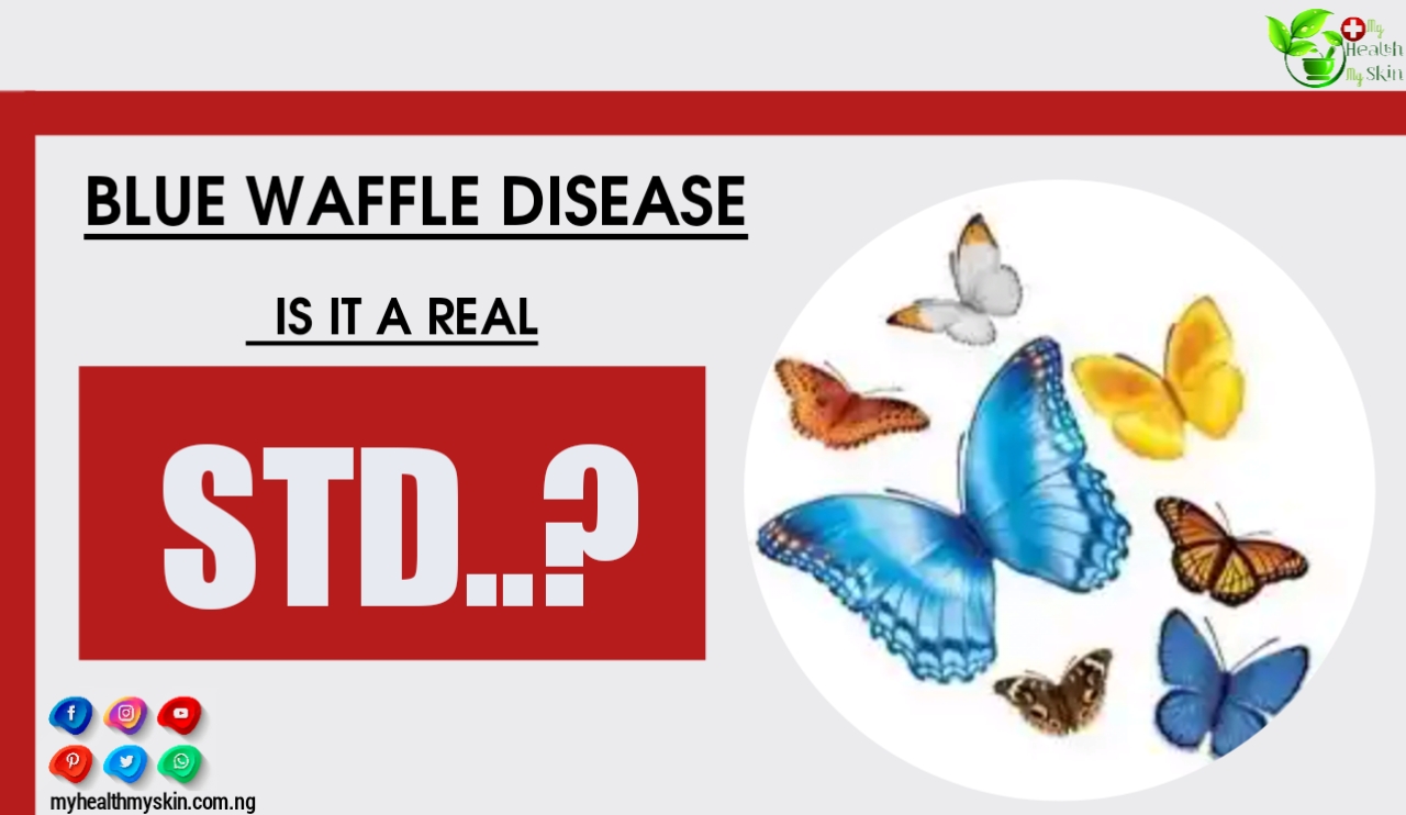 Blue Waffle Disease: Is It A Real Std?