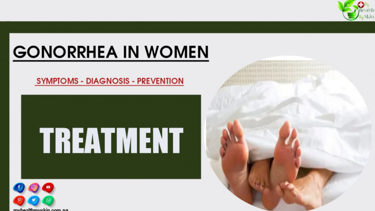 Gonorrhea In Women Symptoms, Diagnosis, Prevention And Treatment