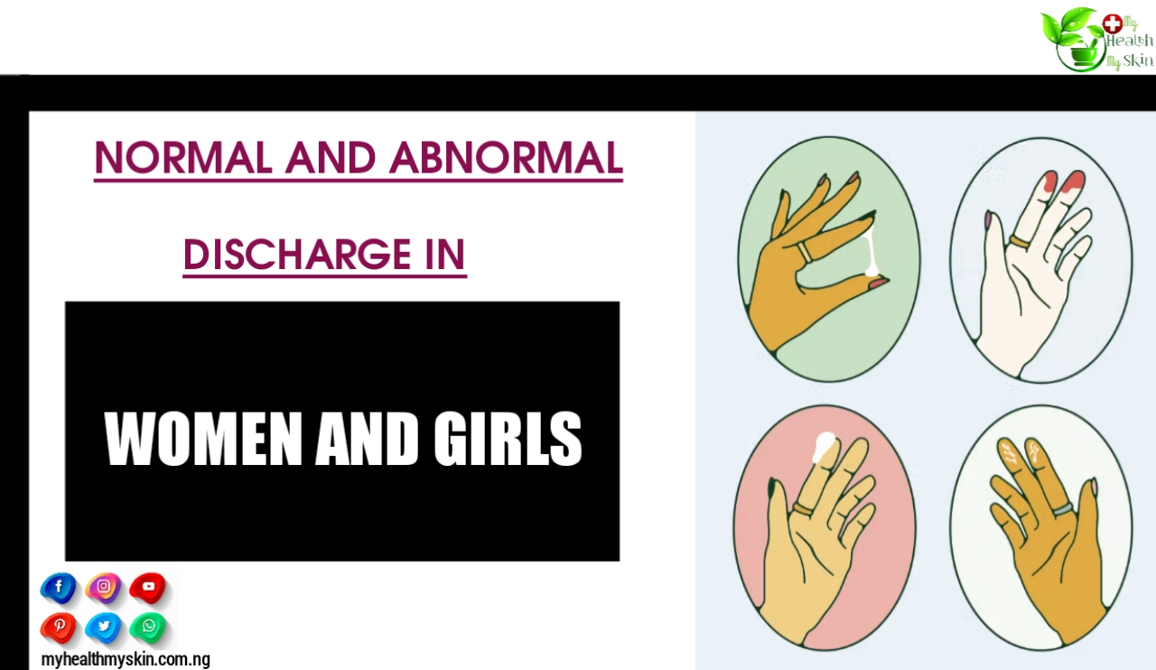 Normal And Abnormal Discharge In Women & Girls