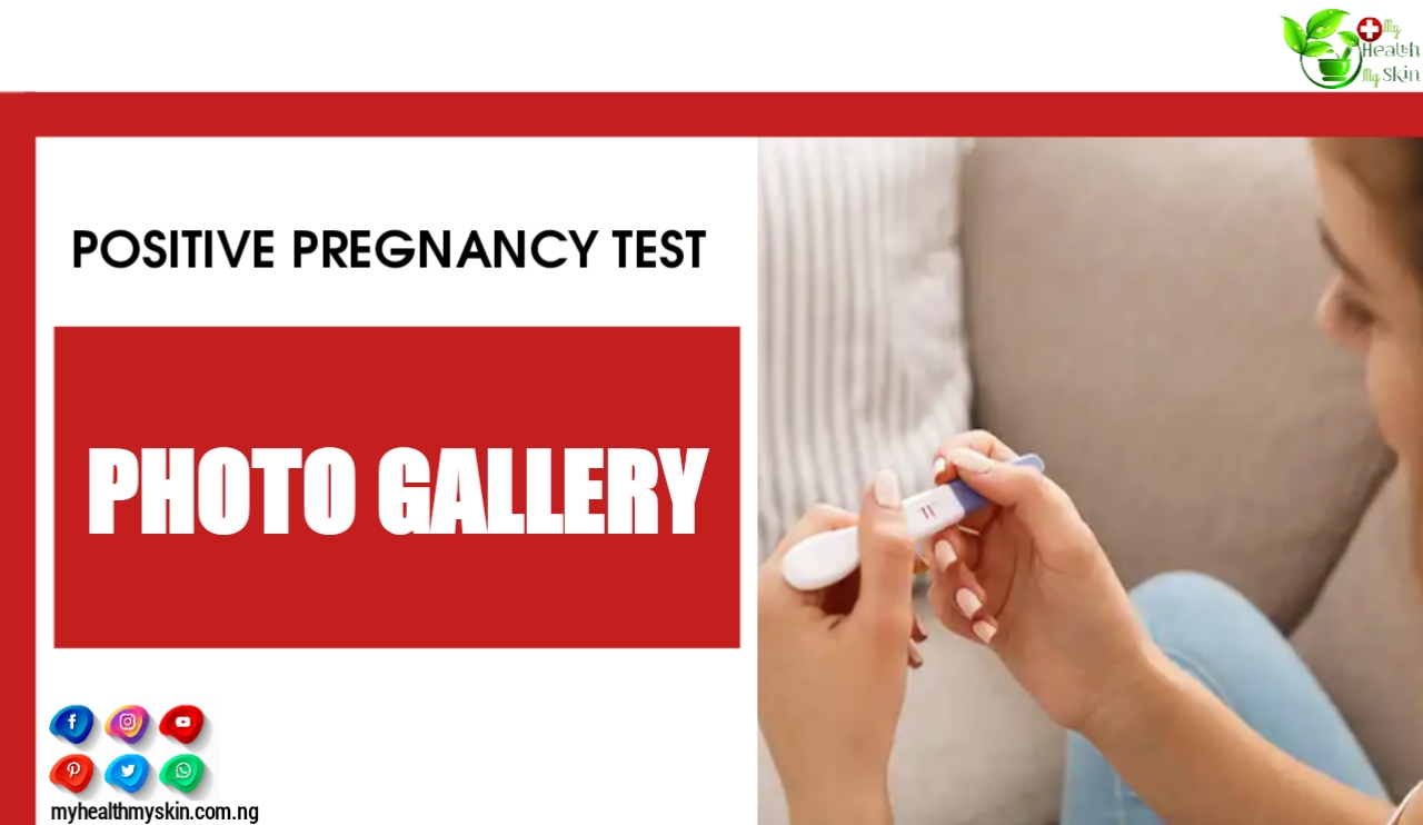 Positive Pregnancy Test – Photo Gallery