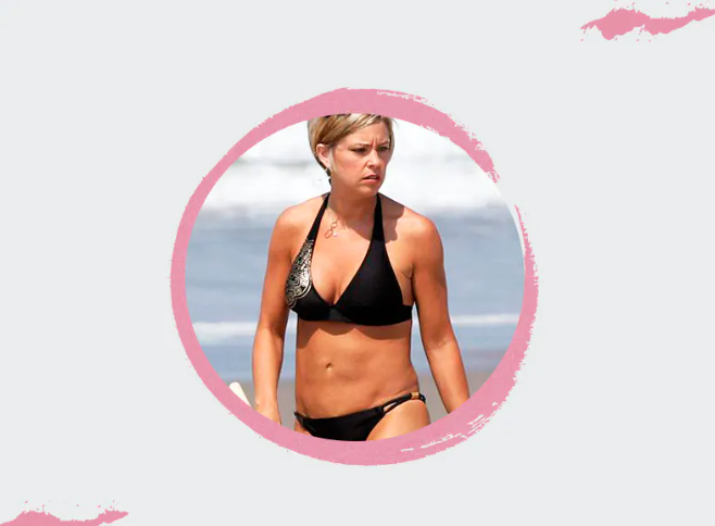 Results of the abdomen surgery of Kate Gosselin, famous American personality