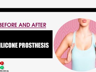 Silicone Prosthesis Before And After: Everything You Need To Know To Achieve The Result Of Your Dreams