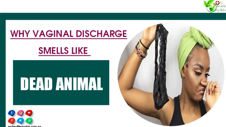 Why Vaginal Discharge Smells Like Dead Animal