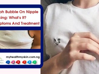 lymph-bubble-on-nipple-piercing-whats-it-symptoms-and-treatment