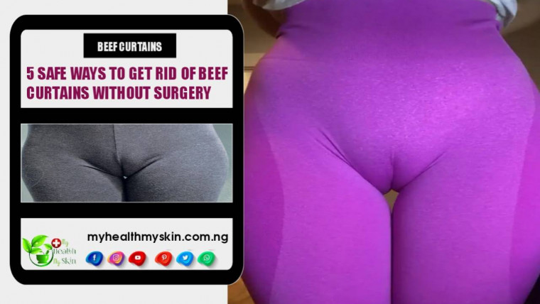 5 Safe Ways To Get Rid Of Beef Curtains Without Surgery