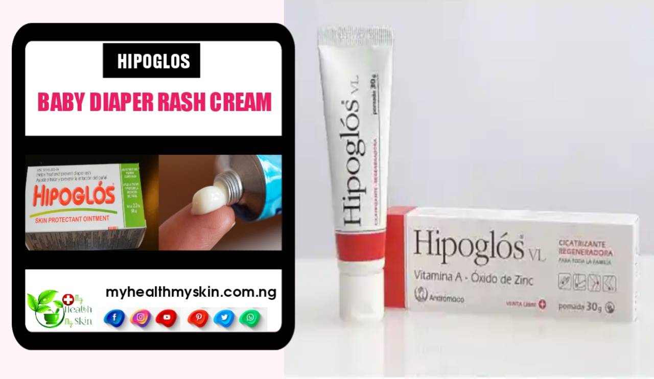 Hipoglos Baby Diaper Rash Cream: Know Everything About This Cream