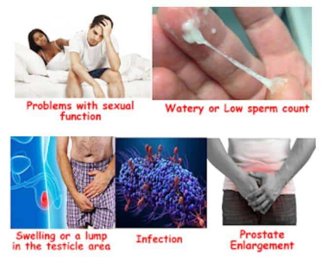 Signs And Symptoms Associated With Male Infertility