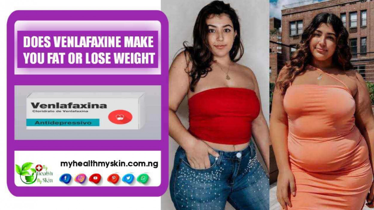 Does Venlafaxine Make You Fat or Lose Weight
