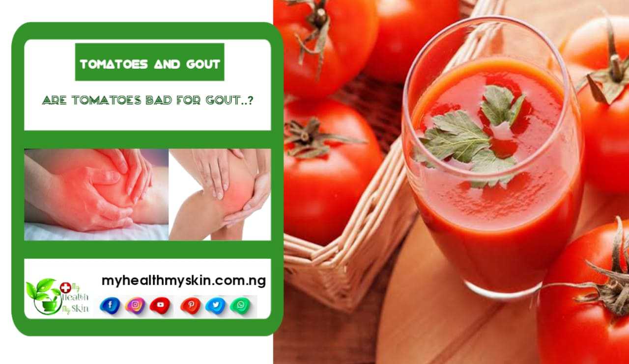 Tomatoes and Gout