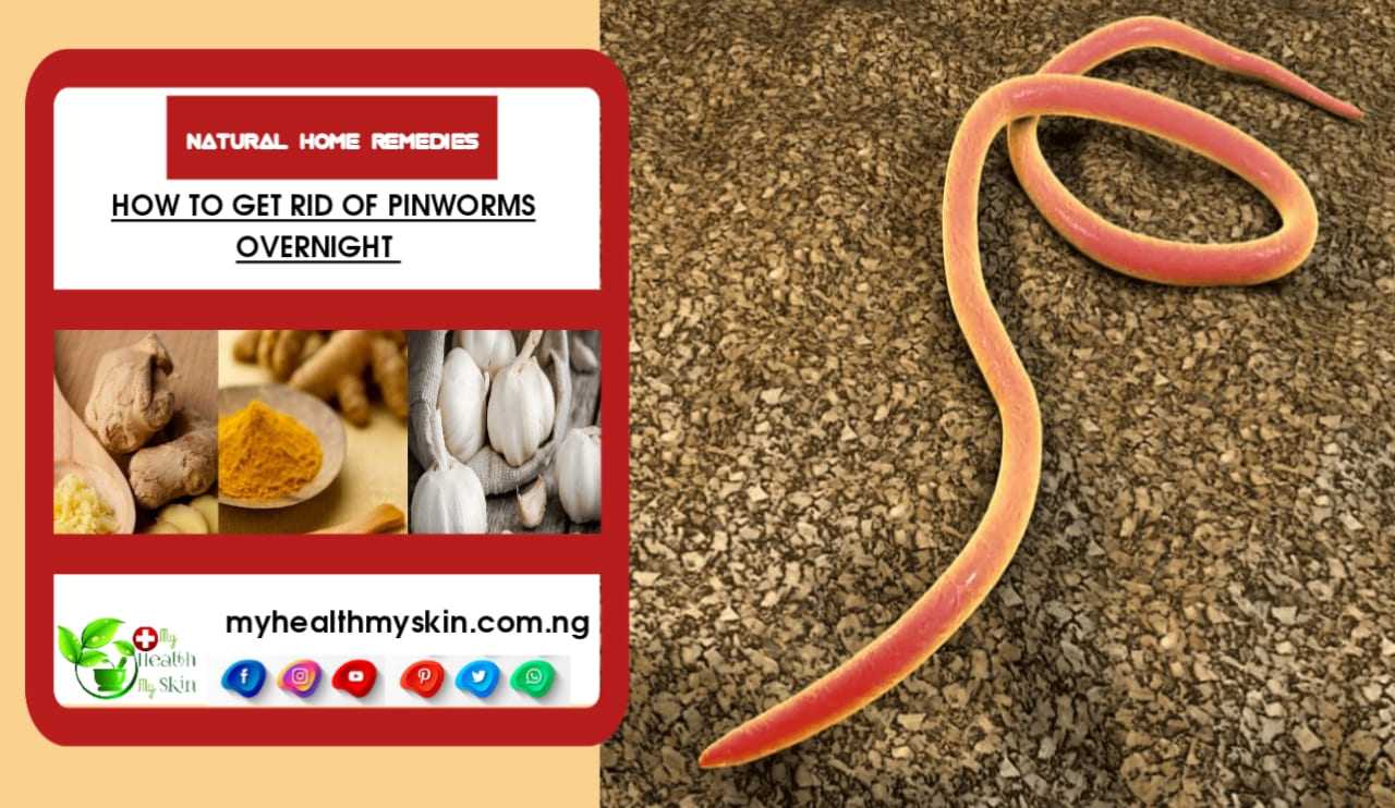 How to Get Rid of Pinworms Overnight? Natural Home Remedies