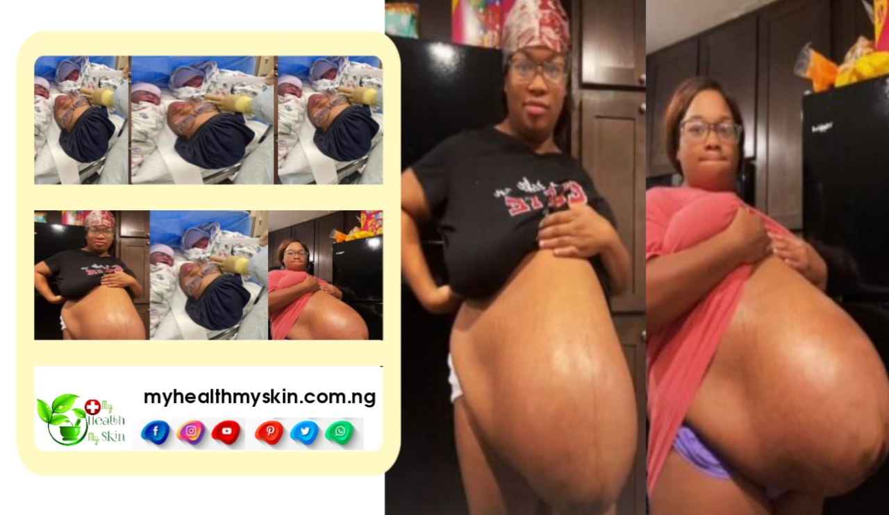 Mum Celebrates as she welcomes set of Twins After Posting Her Huge Baby Bump (Video)