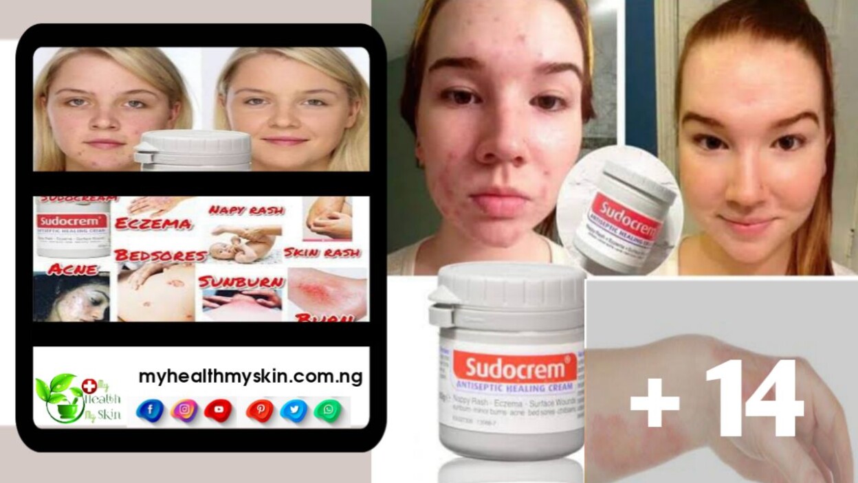 Sudocrem - Instructions For Use And Indications For Children And Adults, Composition