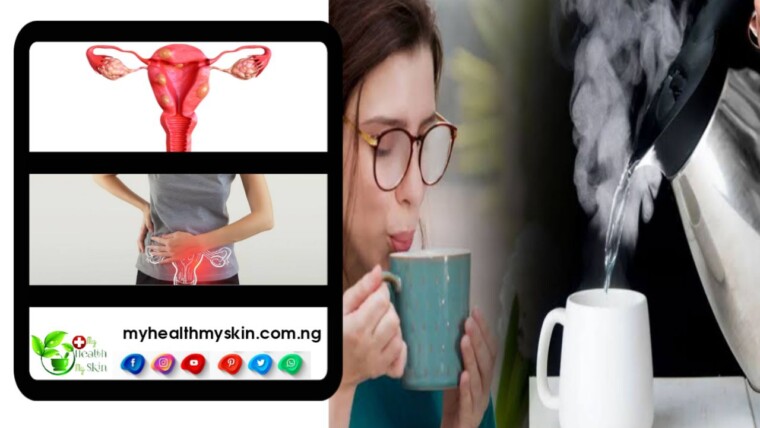 Can drinking hot water shrink fibroids