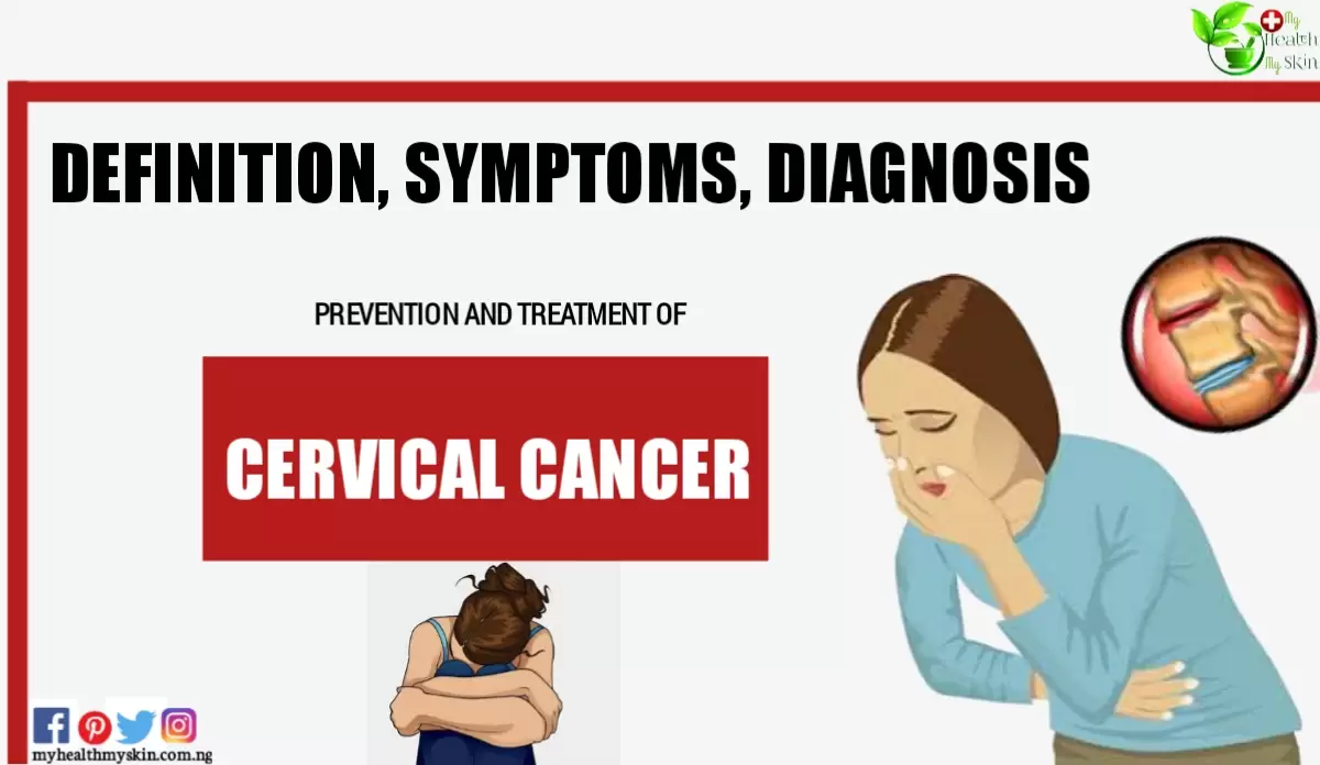 Cervical Cancer Definition Symptoms Diagnosis Prevention and Treatment