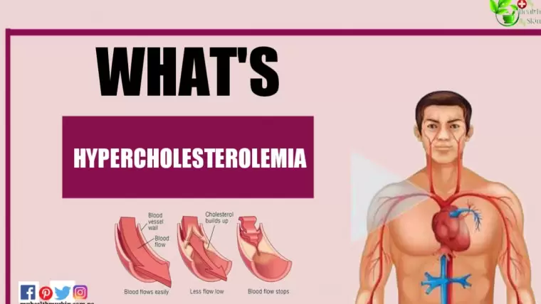 Hypercholesterolemia Definition Causes