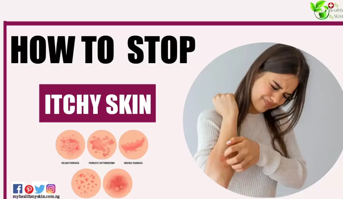 how to stop ITCHY SKIN