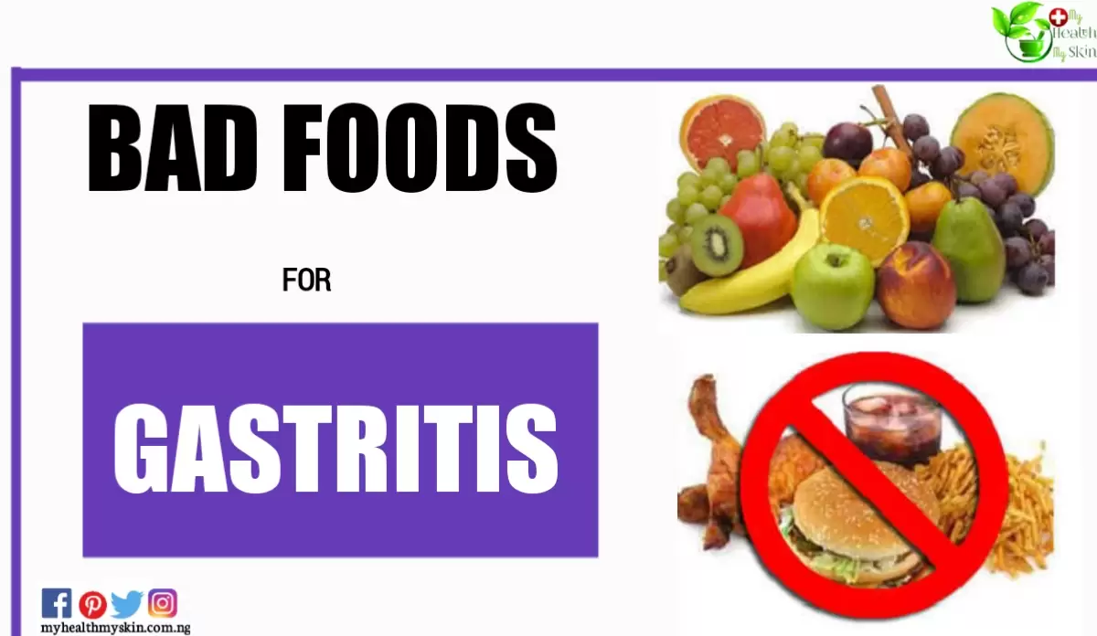 Bad Foods For Gastritis And Other Tips